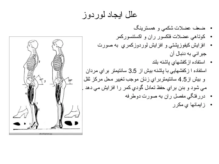 علل ايجاد لوردوز ضعف عضلات شكمي و همسترينگ كوتاهي عضلات فلكسور ران