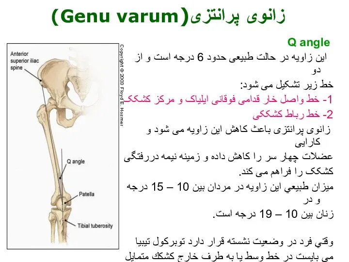 Q angle این زاویه در حالت طبیعی حدود 6 درجه است و