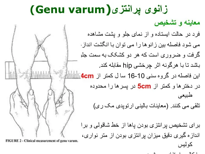 معاینه و تشخیص فرد در حالت ایستاده و از نمای جلو و