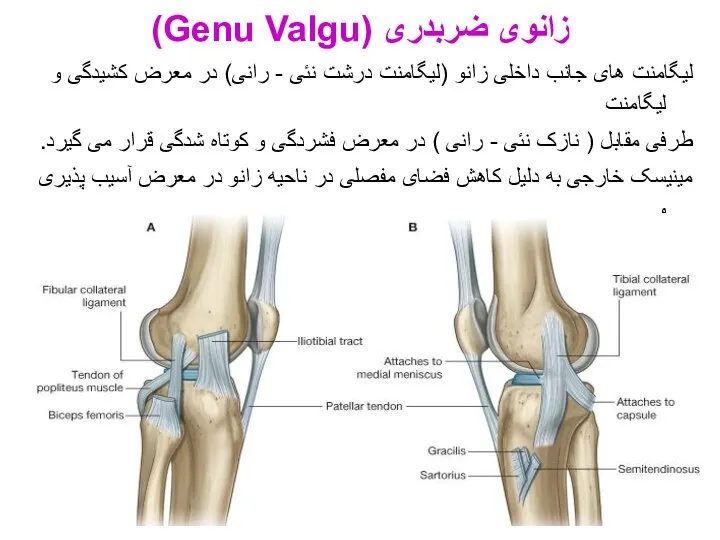 لیگامنت های جانب داخلی زانو (لیگامنت درشت نئی - رانی) در معرض