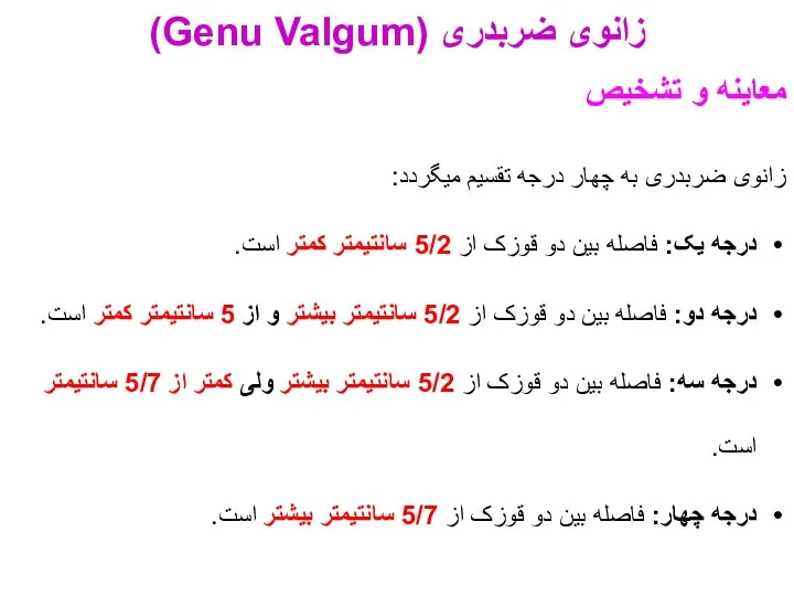 معاینه و تشخیص زانوی ضربدری به چهار درجه تقسیم میگردد: درجه یک: