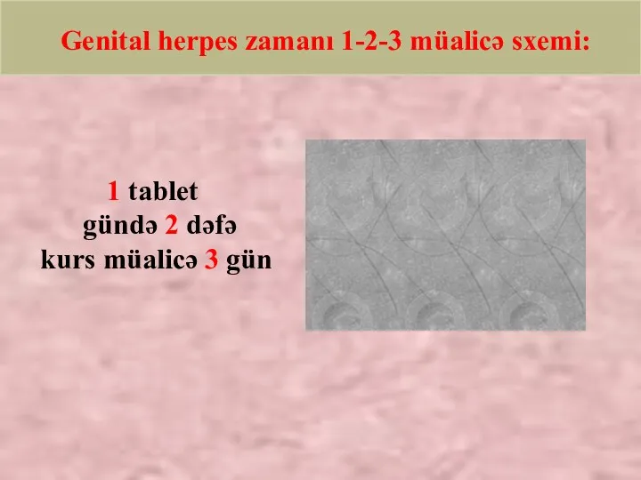 Genital herpes zamanı 1-2-3 müalicə sxemi: 1 tablet gündə 2 dəfə kurs müalicə 3 gün