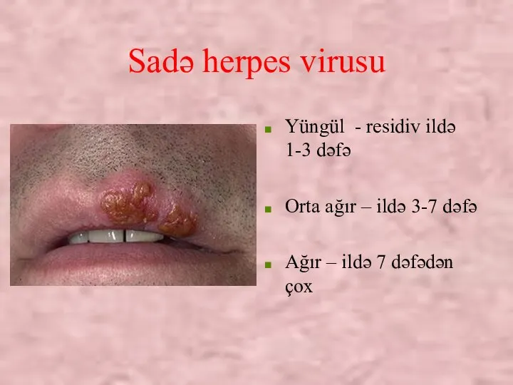 Sadə herpes virusu Yüngül - residiv ildə 1-3 dəfə Orta ağır –