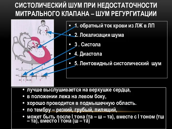 СИСТОЛИЧЕСКИЙ ШУМ ПРИ НЕДОСТАТОЧНОСТИ МИТРАЛЬНОГО КЛАПАНА – ШУМ РЕГУРГИТАЦИИ 1. обратный ток