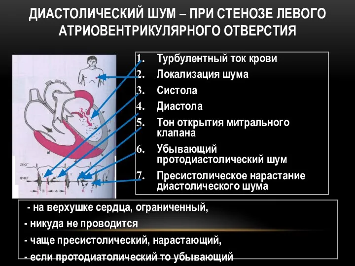 ДИАСТОЛИЧЕСКИЙ ШУМ – ПРИ СТЕНОЗЕ ЛЕВОГО АТРИОВЕНТРИКУЛЯРНОГО ОТВЕРСТИЯ Турбулентный ток крови Локализация