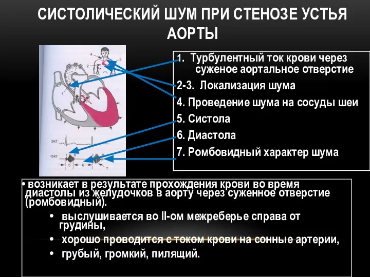 СИСТОЛИЧЕСКИЙ ШУМ ПРИ СТЕНОЗЕ УСТЬЯ АОРТЫ 1. Турбулентный ток крови через суженое