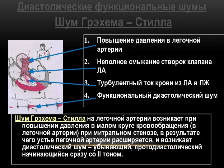 Диастолические функциональные шумы Шум Грэхема – Стилла Повышение давления в легочной артерии