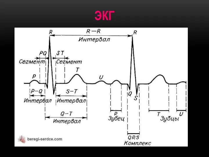 ЭКГ