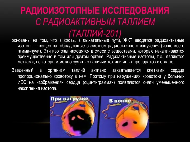 РАДИОИЗОТОПНЫЕ ИССЛЕДОВАНИЯ С РАДИОАКТИВНЫМ ТАЛЛИЕМ (ТАЛЛИЙ-201) основаны на том, что в кровь,