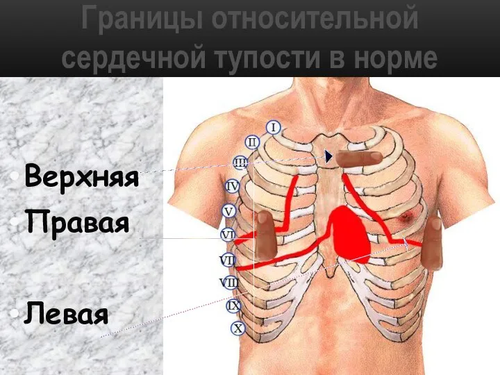 Границы относительной сердечной тупости в норме Верхняя Правая Левая