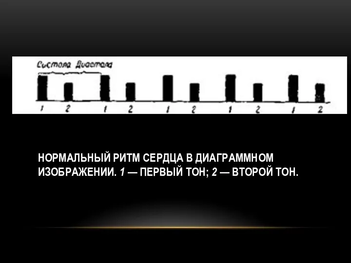 НОРМАЛЬНЫЙ РИТМ СЕРДЦА В ДИАГРАММНОМ ИЗОБРАЖЕНИИ. 1 — ПЕРВЫЙ ТОН; 2 — ВТОРОЙ ТОН.