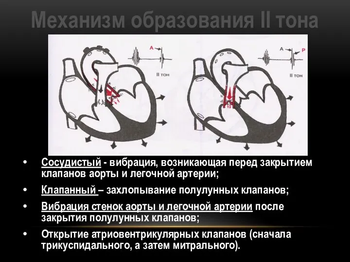 Механизм образования II тона Сосудистый - вибрация, возникающая перед закрытием клапанов аорты