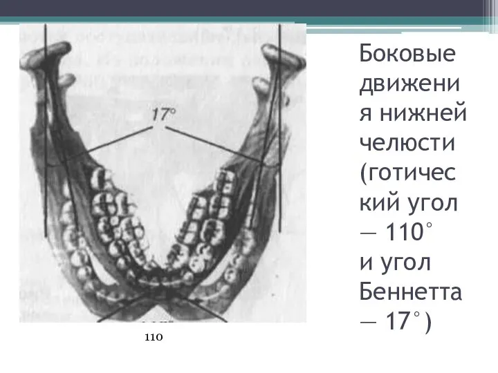 Боковые движения нижней челюсти (готический угол — 110° и угол Беннетта — 17°) 110