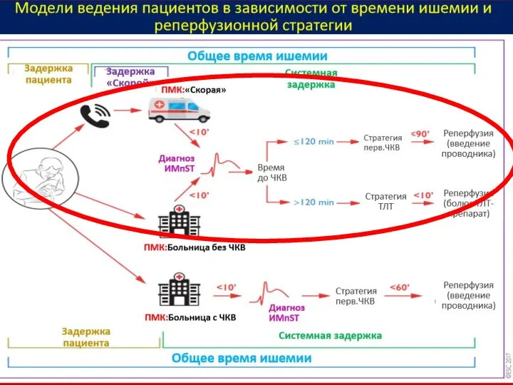 Ежегодно в РФ с ОИМ умирает 55 тыс. больных. При ОКС с