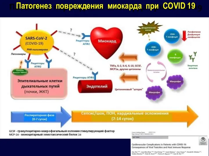 Патогенез повреждения миокарда при COVID 19