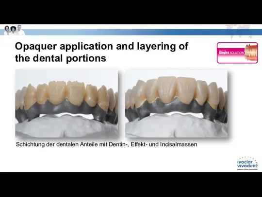 Opaquer application and layering of the dental portions Schichtung der dentalen Anteile