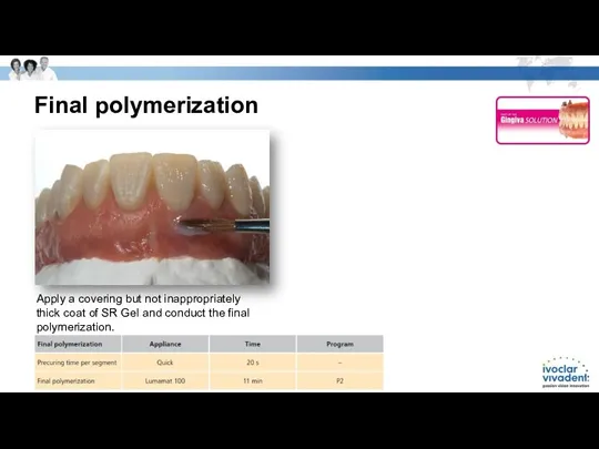 Final polymerization Apply a covering but not inappropriately thick coat of SR