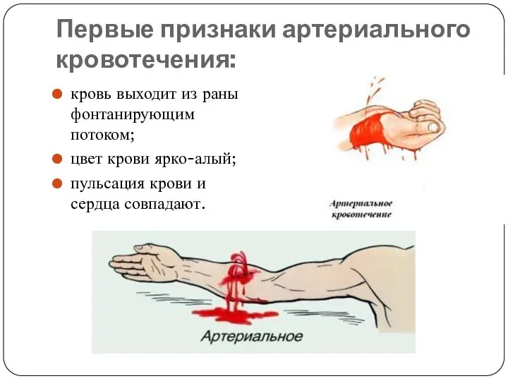 Первые признаки артериального кровотечения: кровь выходит из раны фонтанирующим потоком; цвет крови