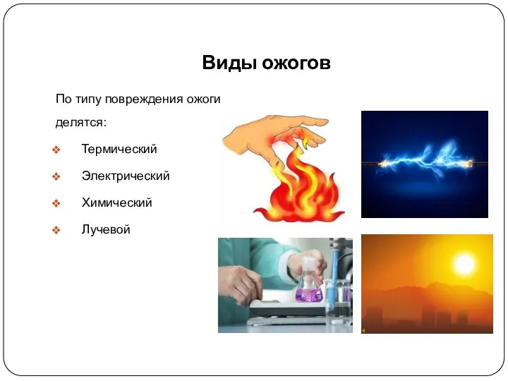 Виды ожогов По типу повреждения ожоги делятся: Термический Электрический Химический Лучевой