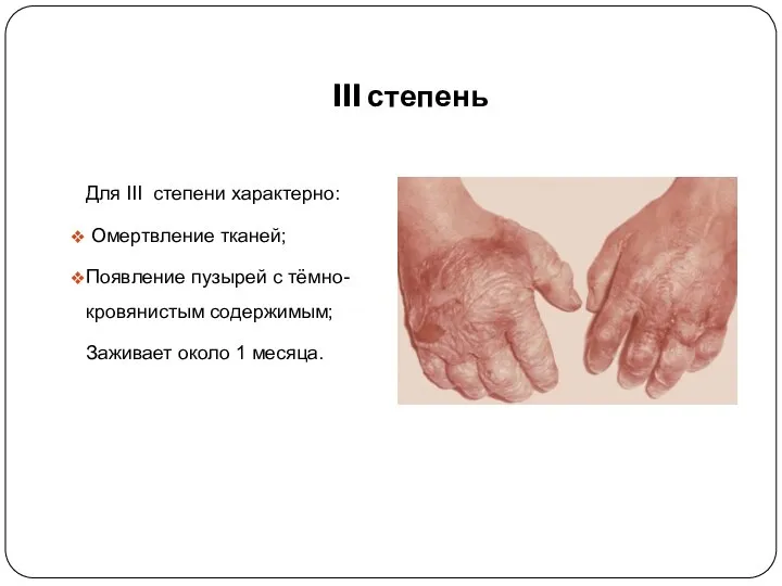 III степень Для III степени характерно: Омертвление тканей; Появление пузырей с тёмно-кровянистым