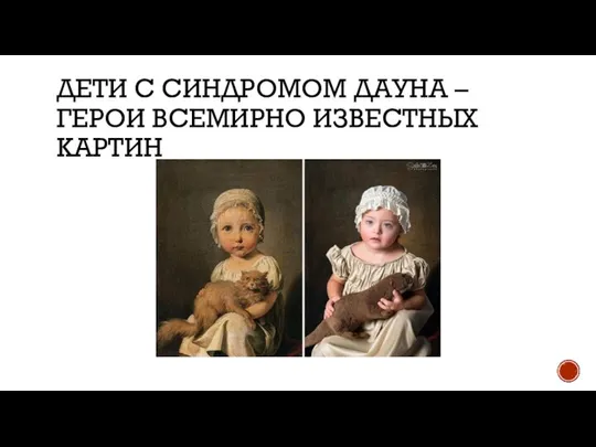 ДЕТИ С СИНДРОМОМ ДАУНА – ГЕРОИ ВСЕМИРНО ИЗВЕСТНЫХ КАРТИН