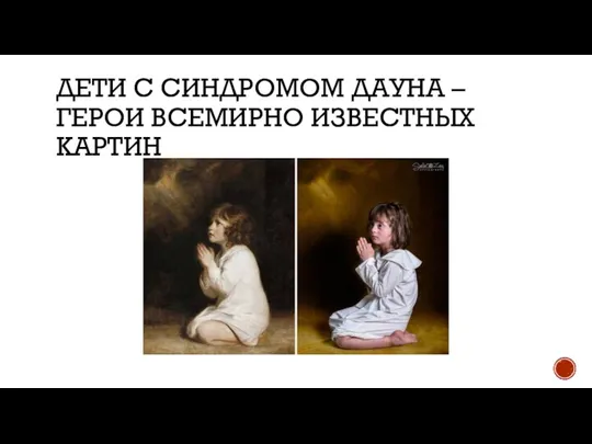 ДЕТИ С СИНДРОМОМ ДАУНА – ГЕРОИ ВСЕМИРНО ИЗВЕСТНЫХ КАРТИН