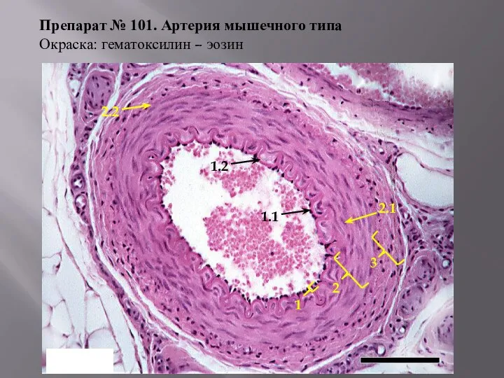 Препарат № 101. Артерия мышечного типа Окраска: гематоксилин – эозин 1 2