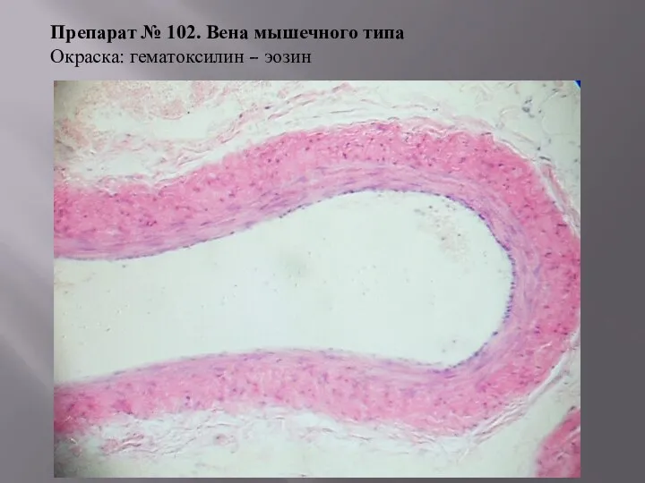 Препарат № 102. Вена мышечного типа Окраска: гематоксилин – эозин