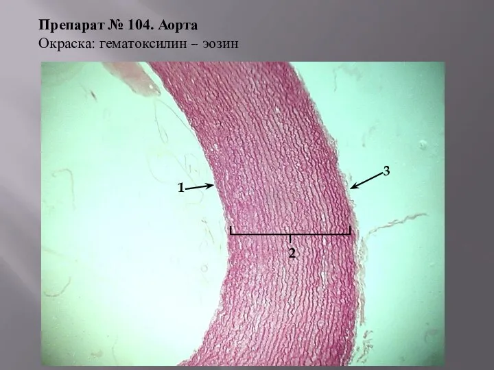 Препарат № 104. Аорта Окраска: гематоксилин – эозин 2 1 3