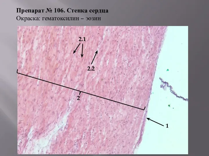 Препарат № 106. Стенка сердца Окраска: гематоксилин – эозин 1 2 2.2 2.1