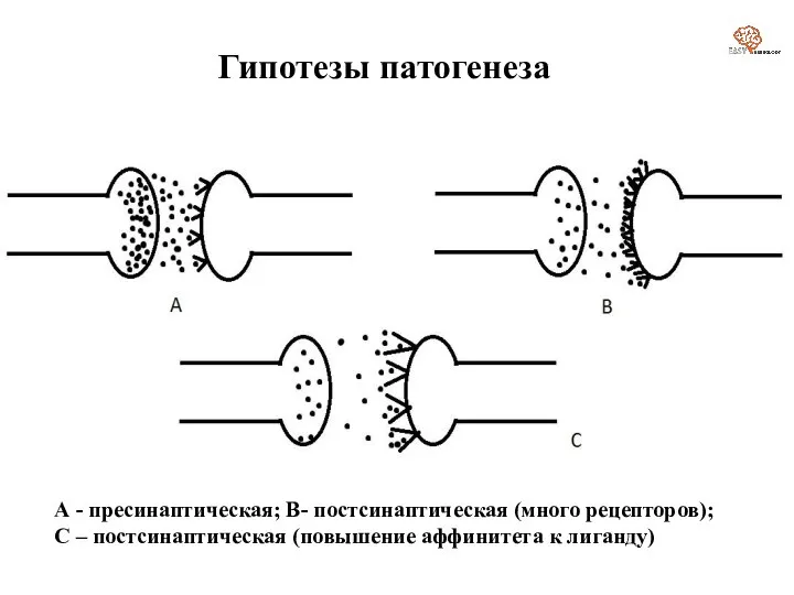 Гипотезы патогенеза А - пресинаптическая; В- постсинаптическая (много рецепторов); С – постсинаптическая (повышение аффинитета к лиганду)