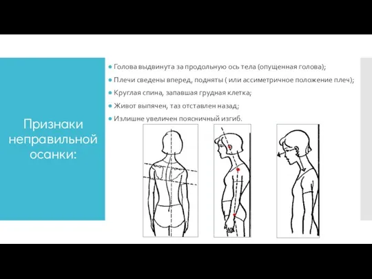 Признаки неправильной осанки: Голова выдвинута за продольную ось тела (опущенная голова); Плечи