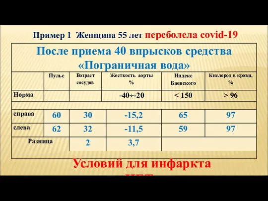 Пример 1 Женщина 55 лет переболела covid-19 Условий для инфаркта НЕТ.