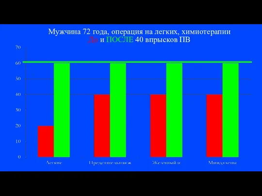 Мужчина 72 года, операция на легких, химиотерапии До и ПОСЛЕ 40 впрысков ПВ