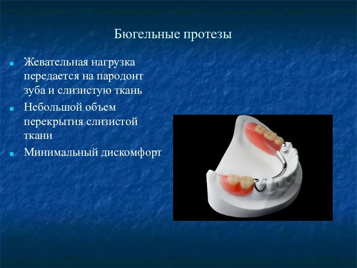 Бюгельные протезы Жевательная нагрузка передается на пародонт зуба и слизистую ткань Небольшой