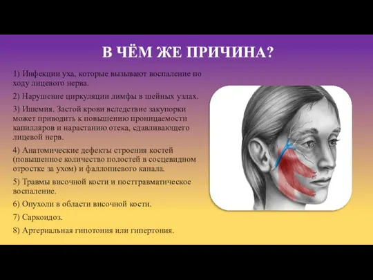 В ЧЁМ ЖЕ ПРИЧИНА? 1) Инфекции уха, которые вызывают воспаление по ходу