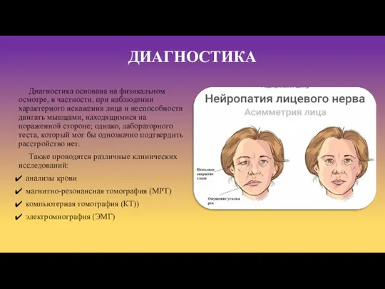 Диагностика основана на физикальном осмотре, в частности, при наблюдении характерного искажения лица