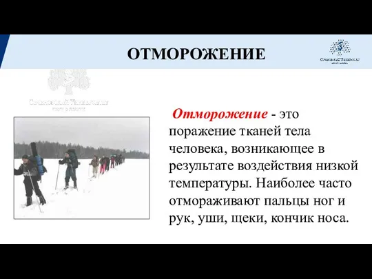 Отморожение - это поражение тканей тела человека, возникающее в результате воздействия низкой