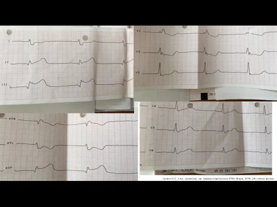 Галявич А.С., д.м.н., профессор, зав. кафедрой кардиологии КГМУ, Казань, 2016г (Из личного архива)