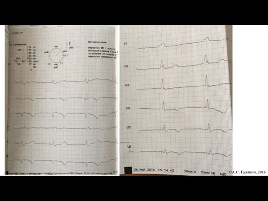 ©А.С. Галявич, 2016 Галявич А.С., д.м.н., профессор, зав. кафедрой кардиологии КГМУ, Казань, 2016г (Из личного архива)