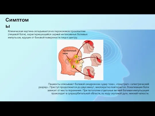 Симптомы Клиническая картина складывается из пароксизмов прозопалгии (лицевой боли), характеризующейся серией интенсивных
