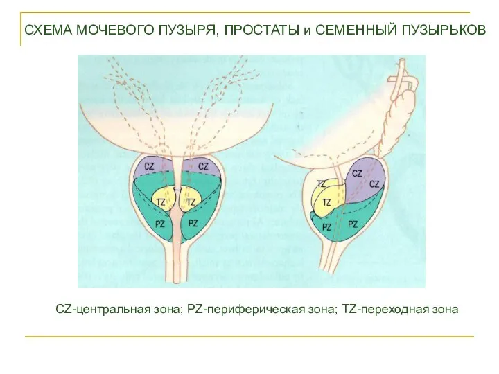 СХЕМА МОЧЕВОГО ПУЗЫРЯ, ПРОСТАТЫ и СЕМЕННЫЙ ПУЗЫРЬКОВ CZ-центральная зона; PZ-периферическая зона; TZ-переходная зона