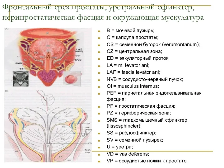 Фронтальный срез простаты, уретральный сфинктер, перипростатическая фасция и окружающая мускулатура B =