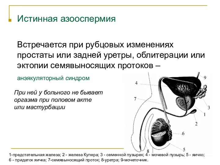 Истинная азооспермия Встречается при рубцовых изменениях простаты или задней уретры, облитерации или