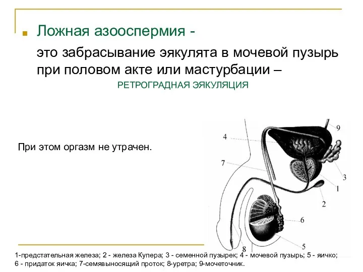 Ложная азооспермия - это забрасывание эякулята в мочевой пузырь при половом акте