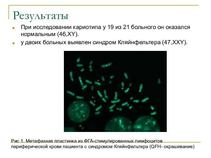 Результаты При исследовании кариотипа у 19 из 21 больного он оказался нормальным