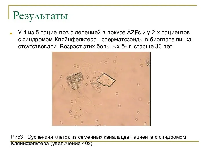 Результаты У 4 из 5 пациентов с делецией в локусе AZFc и