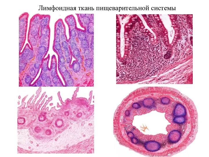 Лимфоидная ткань пищеварительной системы