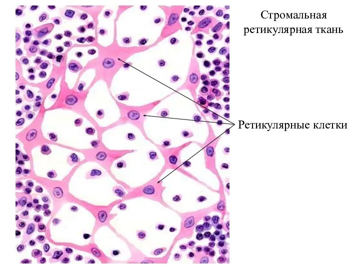 Стромальная ретикулярная ткань Ретикулярные клетки