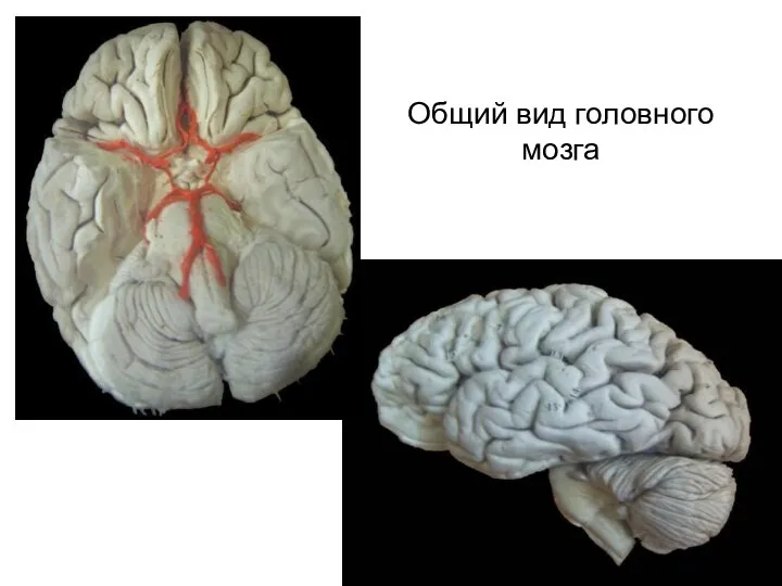 Общий вид головного мозга